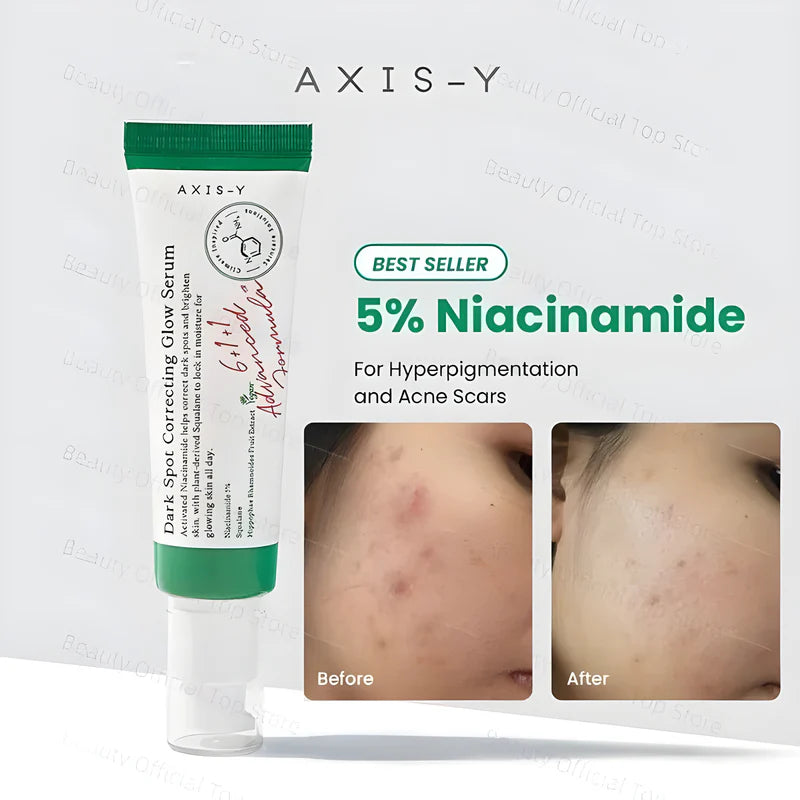 𝗔𝗫𝗜𝗦-𝗬 𝗗𝗔𝗥𝗞 𝗦𝗣𝗢𝗧 𝗖𝗢𝗥𝗥𝗘𝗖𝗧𝗜𝗡𝗚 𝗦𝗘𝗥𝗨𝗠